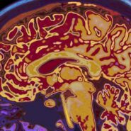 Des chercheurs conçoivent un réseau de neurones artificiels