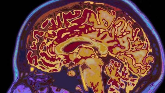 IRM colorée montrant une coupe du cerveau humain